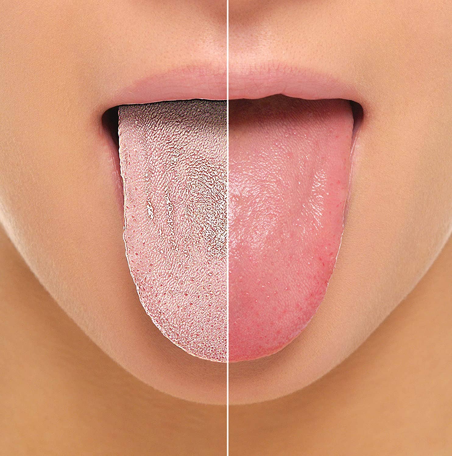 Copper Tongue Cleaner